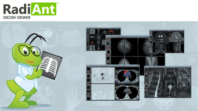 RadiAnt DICOM Viewer 